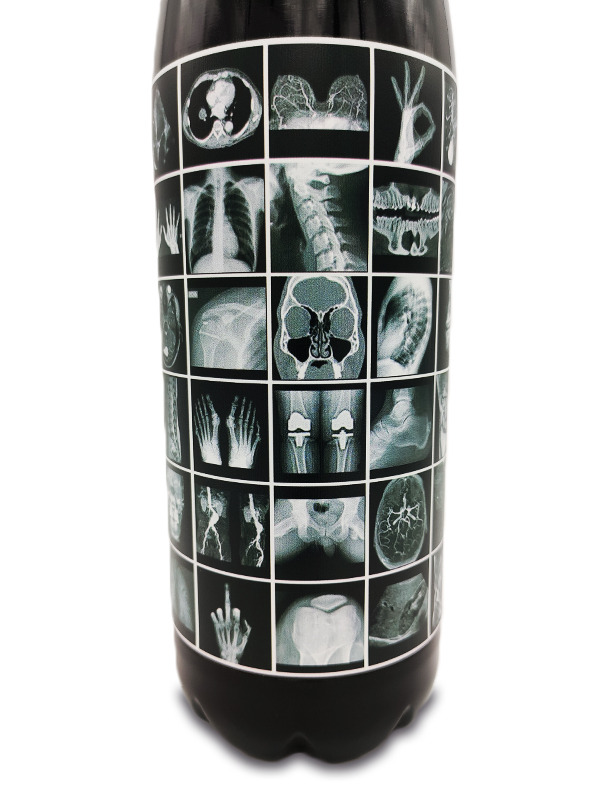 Botella Térmica Acero Inoxidable 1 Litro | Modelo Radiodiagnóstico (Negra Brillante)